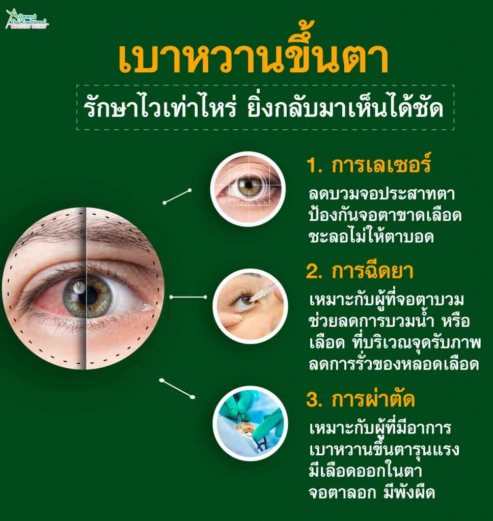 เบาหวานขึ้นตา รักษาไวเท่าไหร่ ยิ่งกลับมาเห็นได้ชัด
1. การเลเซอร์ : ลดบวมจอประสาทตา ป้องกันจอตาขาดเลือด ชะลอไม่ให้ตาบอด
2. การฉีดยา : เหมาะกับผู้ที่จอตาบวม ช่วยลดการบวมน้ำ หรือ เลือด ที่บริเวณจุดรับภาพ ลดการรั่วของหลอดเลือด 
3. การผ่าตัด : เหมาะกับผู้ที่มีอาการเบาหวานขึ้นตารุนแรง มีเลือดออกในตา จอตาลอก มีพังผืด 