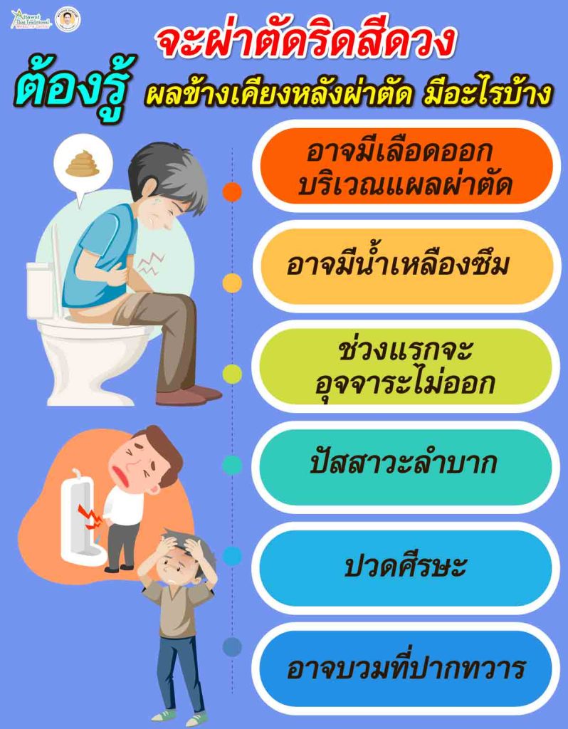 จะผ่าตัดริดสีดวง ต้องรู้ ผลข้างเคียงหลังผ่าตัด มีอะไรบ้าง
อาจมีเลือดออก บริเวณแผลผ่าตัด 
อาจมีน้ำเหลืองซึม 
ช่วงแรกจะอุจจาระไม่ออก 
ปัสสาวะลำบาก 
ปวดศีรษะ
อาจบวมที่ปากทวาร